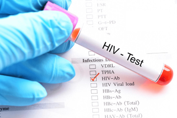 کیت ایدز یا کیت خانگی تشخیص سریع HIV و انواع آن